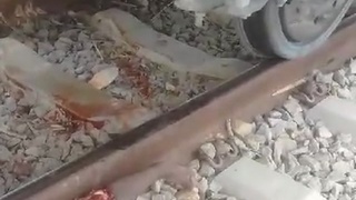 Angolan has arm and leg severed by train