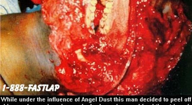 The Face of an Angel (Dust)