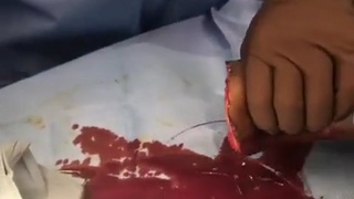 foot is off