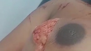 Woman injured in breasts and face with machete attack
