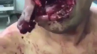 Bull rips man&rsquo;s face open