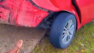 Woman in car accident left faceless