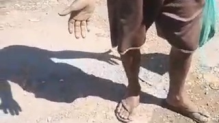 shot in butt