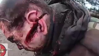 It's just a scratch