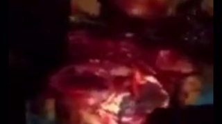Chest cut open during beheading
