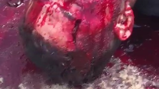 It's agony that a bloody man collided with a motorcycle