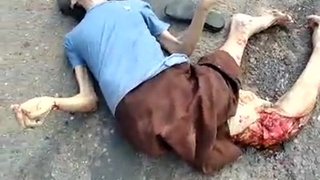 Elderly  lady ran over by truck and trailor