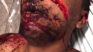 Man's face slit open diagonally