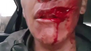victim of machete