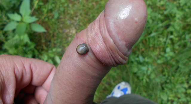 Tick on dick