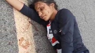 poor Brazilian woman thrown to the ground with her leg skinned