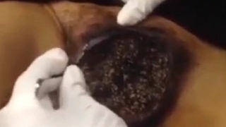 https://www.mazterlocuras.net/2023/07/15/mujer-sin-hogar-con-vagina-repleta-de-gusanos/