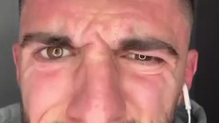 Eye Eye