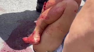 Beautiful girl has her legs crushed