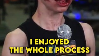 Female Bare Knuckle Fighter Gets Face Adjusted..