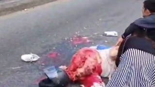 man has lacerated leg