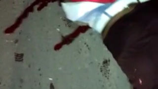 victim of terrible accident