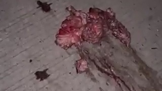 man collapsed when he hit the pole