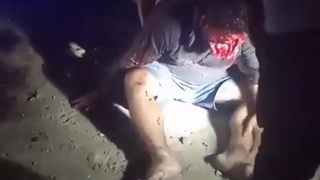 Fat man gets his face ripped off in a horrible accident