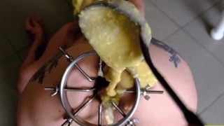 Anal&hellip;..