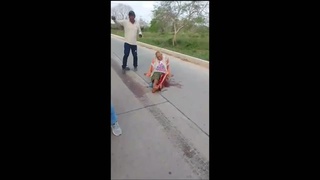 poor old man he has his leg skinned