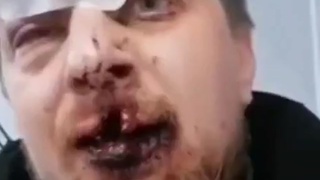 Ukrainian volunteer gets beat up by ukronazis