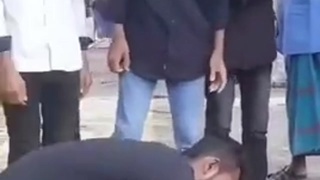 Snake Handler Tries to Stop Venom