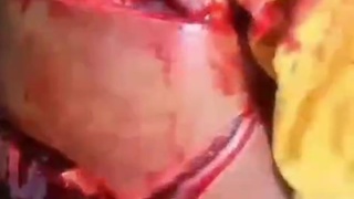 terrible machete attack