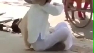 Monkey rips off part of man's scalp