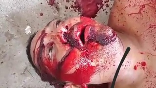 agony