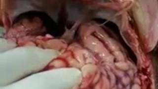 Brain