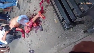 Lucky Young Man Survived A Sicario Attack
