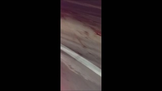 the man had one leg horribly destroyed and the other dies violently in a Brazilian accident receive the shit I'm going to eat a good smell in this bed