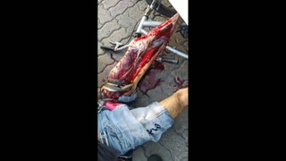 victim had his leg shattered