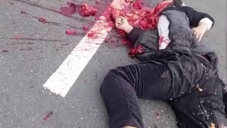 Motorcyclist get head busted open