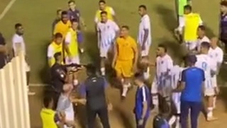 Brazilian goalkeeper shot in leg