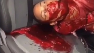 A dude bleeds out from his mouth