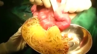 Spaghetti or intestinal worms?