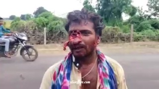 Drunk Motorcyclist Face Gore