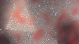 kite line cuts deep in biker hand