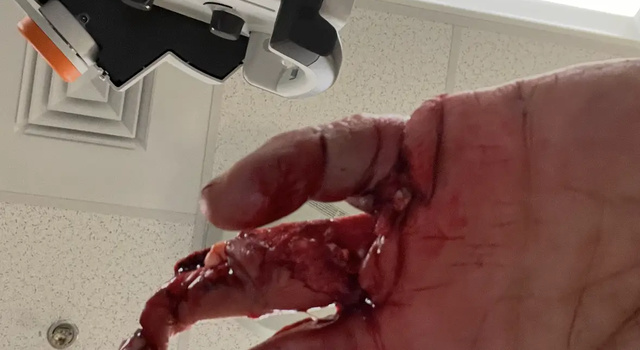 A table saw, yes, it was she who served this nightmare