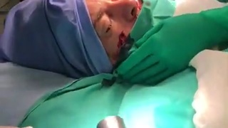 Spear Removal