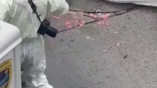 He lost his brain