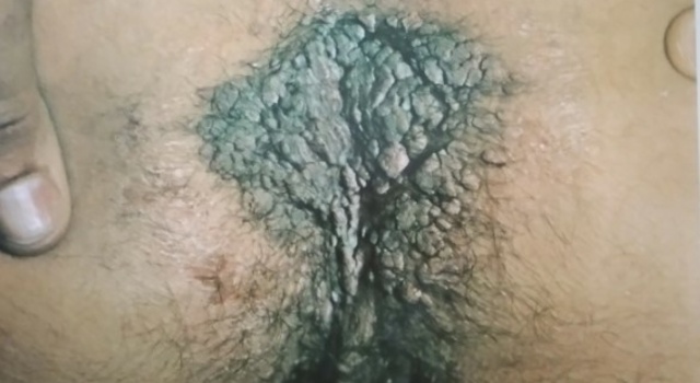 Talk about a mud hole