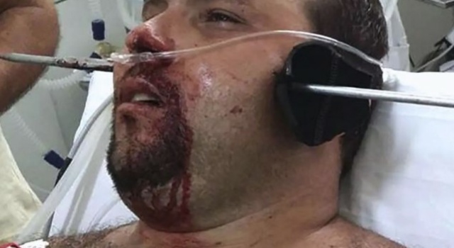 Spearfishing is dangerous