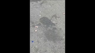 something stuck in your eye yo