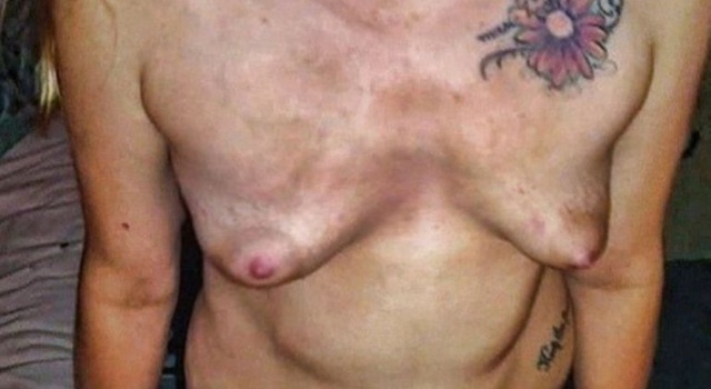 blonde 32yo wife with terrible little wonky tits