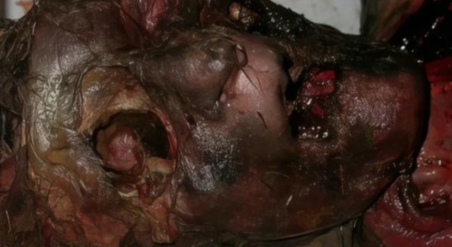 Putrefaction