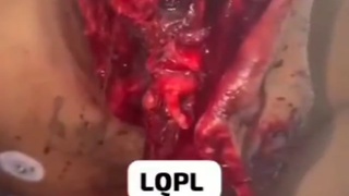 Bull Disfigures Colombian