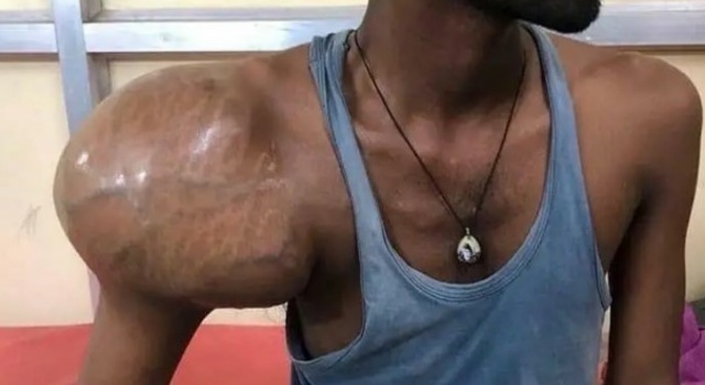 Workin` that deltoid